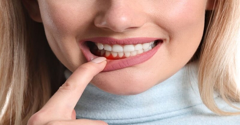 Home remedies on gums pain