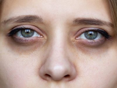 Tips To Reduce Dark Circles | महागड्या क्रिम्सने सुद्धा डोळ्याखालील डार्क सर्कल दुर होतं नाहीत?, नैसर्गिकरित्या घालवण्यासाठी या टिप्स फॉलो करा
