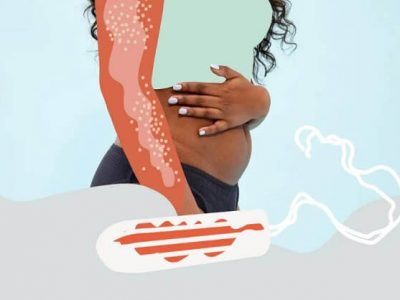 Health First | टॉक्सिक शॉक सिंड्रोम | महिलांच्या आरोग्याला ठरतोय घातक | लक्षणे जाणून घ्या