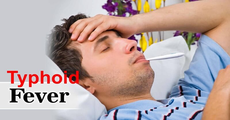 Typhoid symptoms and Treatment
