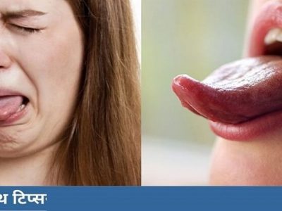 Health First | तोंड कडू होण्याची ‘ही’ आहेत कारणं – नक्की वाचा