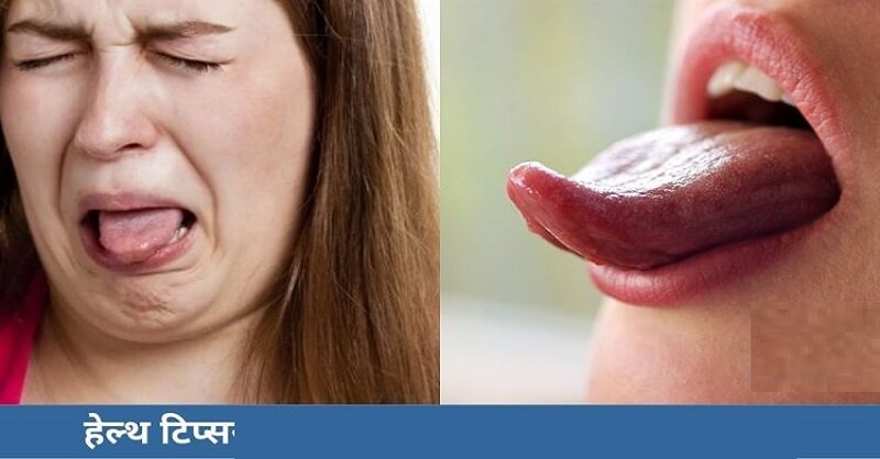 Bitter taste in mouth causes and remedies