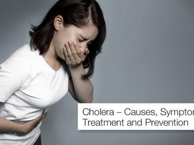Cholera symptoms and Treatment | ‘कॉलरा’ आजारावर त्वरित उपचार गरजेचे | लक्षण व उपचार – नक्की वाचा