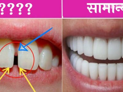 Health First | दातांमध्ये फट असणाऱ्या लोकांमध्ये असतात हे सकारात्मक गुण | नक्की वाचा