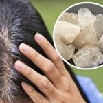 White hairs, black hairs, Health and Fitness, Health Science