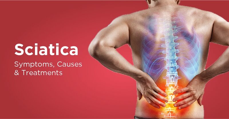 Sciatica symptoms and causes
