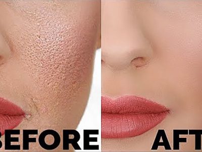Beauty First | खडबडीत त्वचेला मेकअपने द्या असा स्मूथ लुक – नक्की वाचा